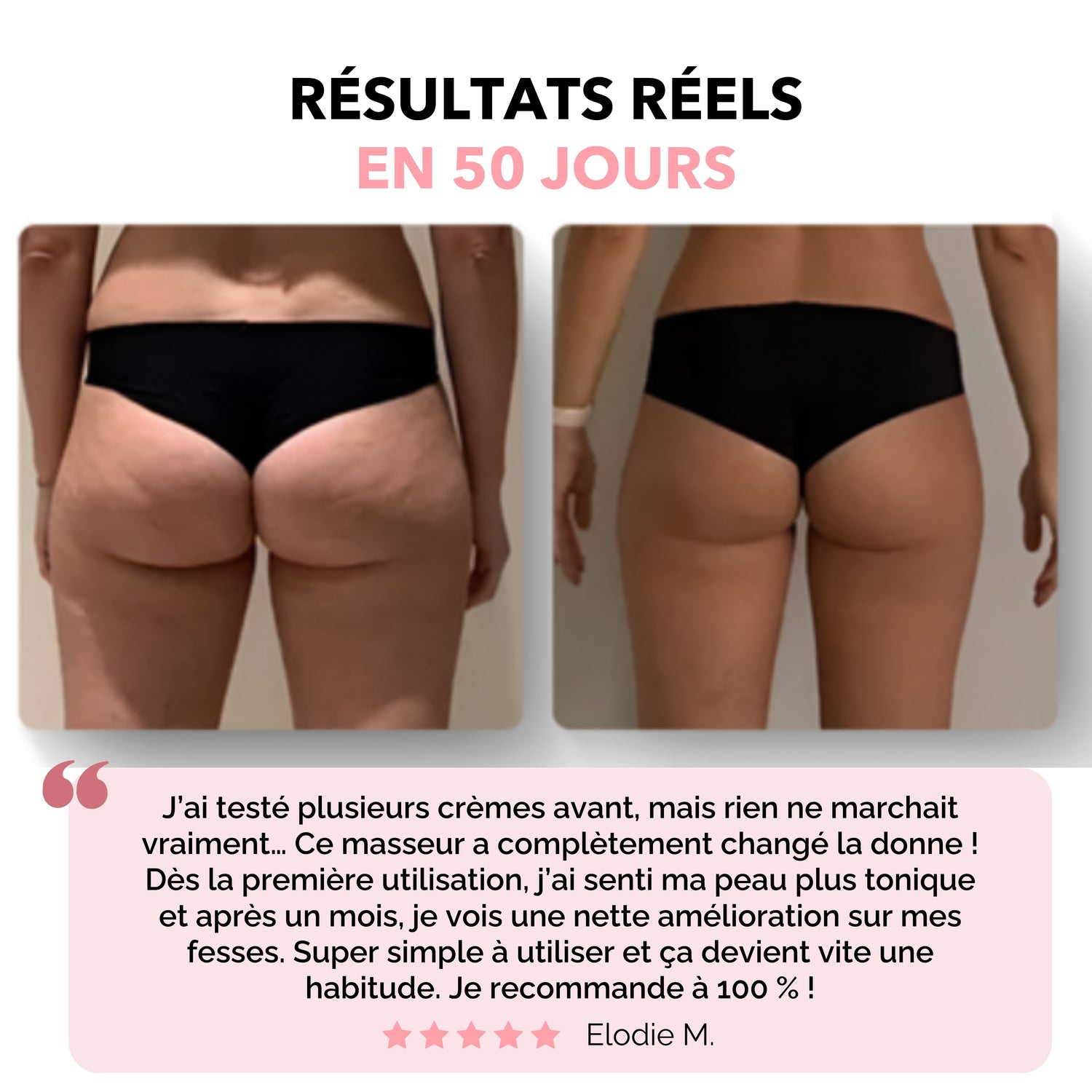 masseur anti cellulite