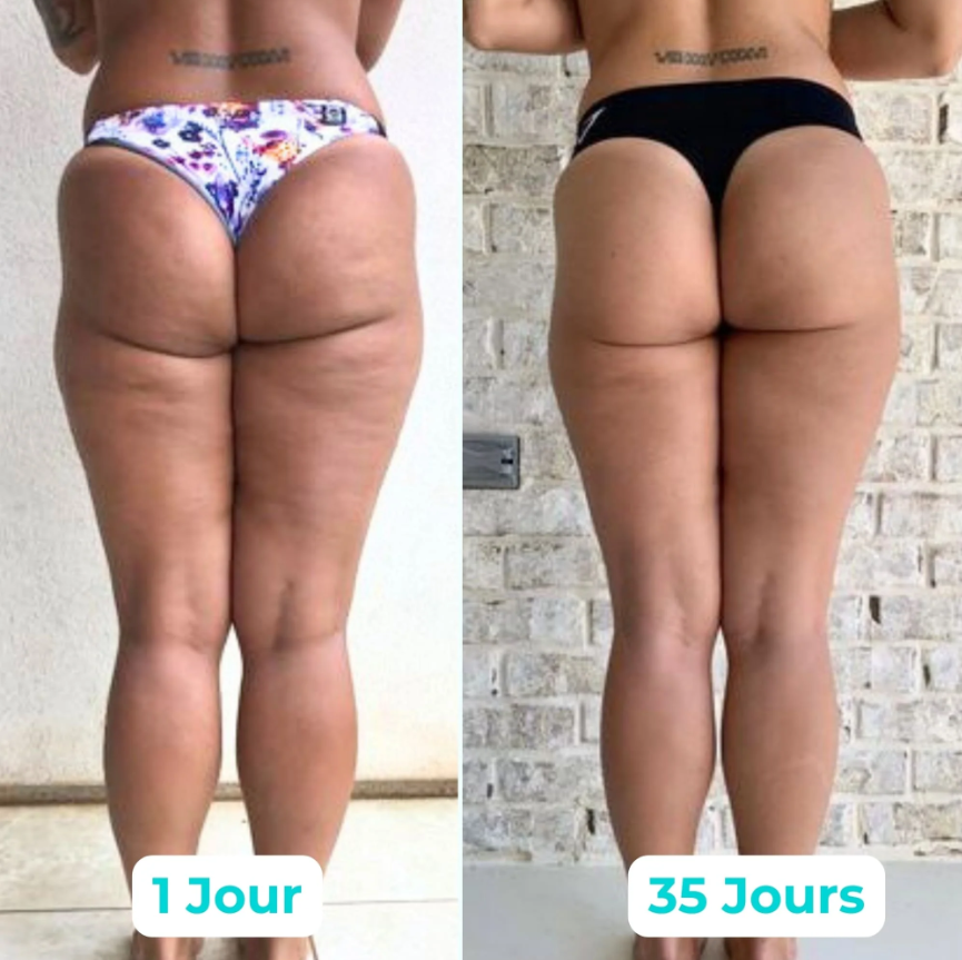 AXEPLUSS Anti-cellulite