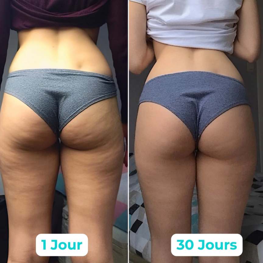 AXEPLUSS Anti-cellulite
